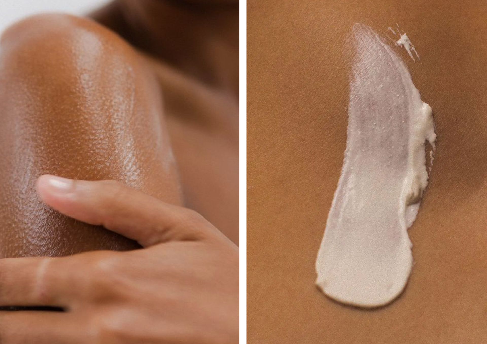 Skin Microbiome: What It Is and Why It Matters