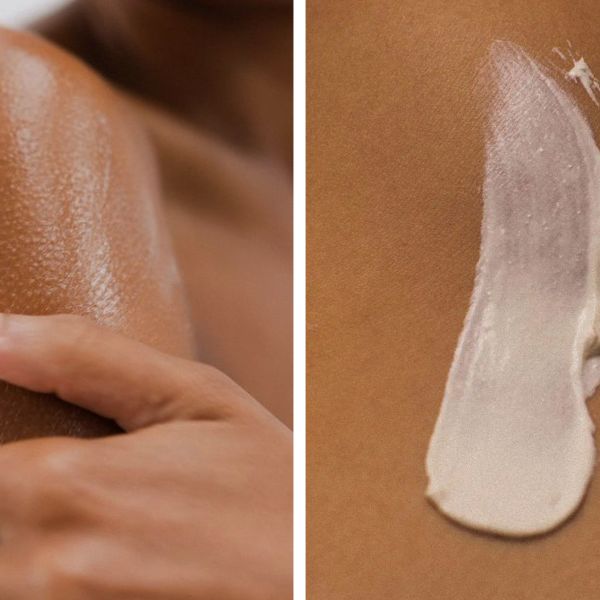 Skin Microbiome: What It Is and Why It Matters