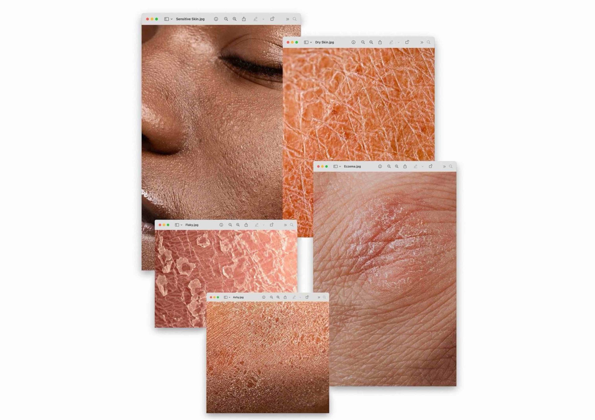 Dry hands in summer: why it happens and how to restore comfort