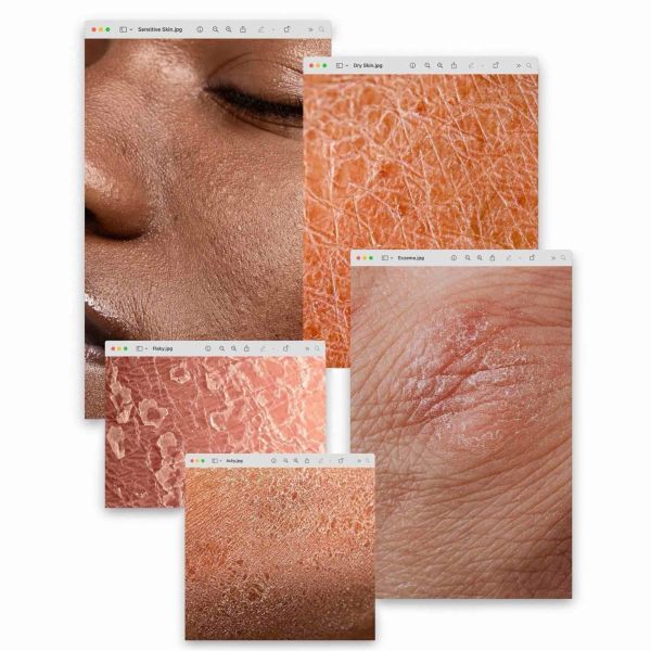 Dry hands in summer: why it happens and how to restore comfort