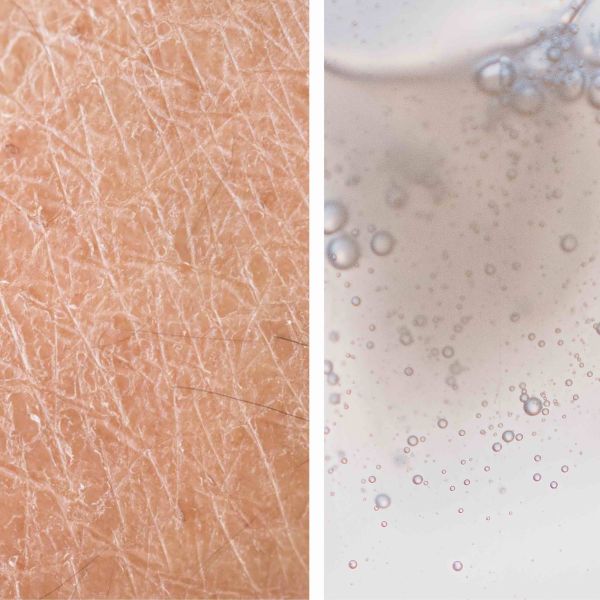Why does skin become dry after a shower, and how can you prevent it?